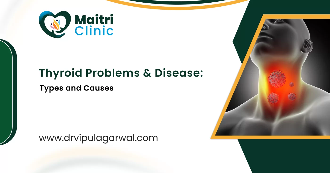 Thyroid Problems & Disease: Types and Causes