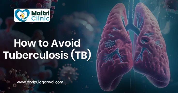 How to Avoid Tuberculosis (TB)?